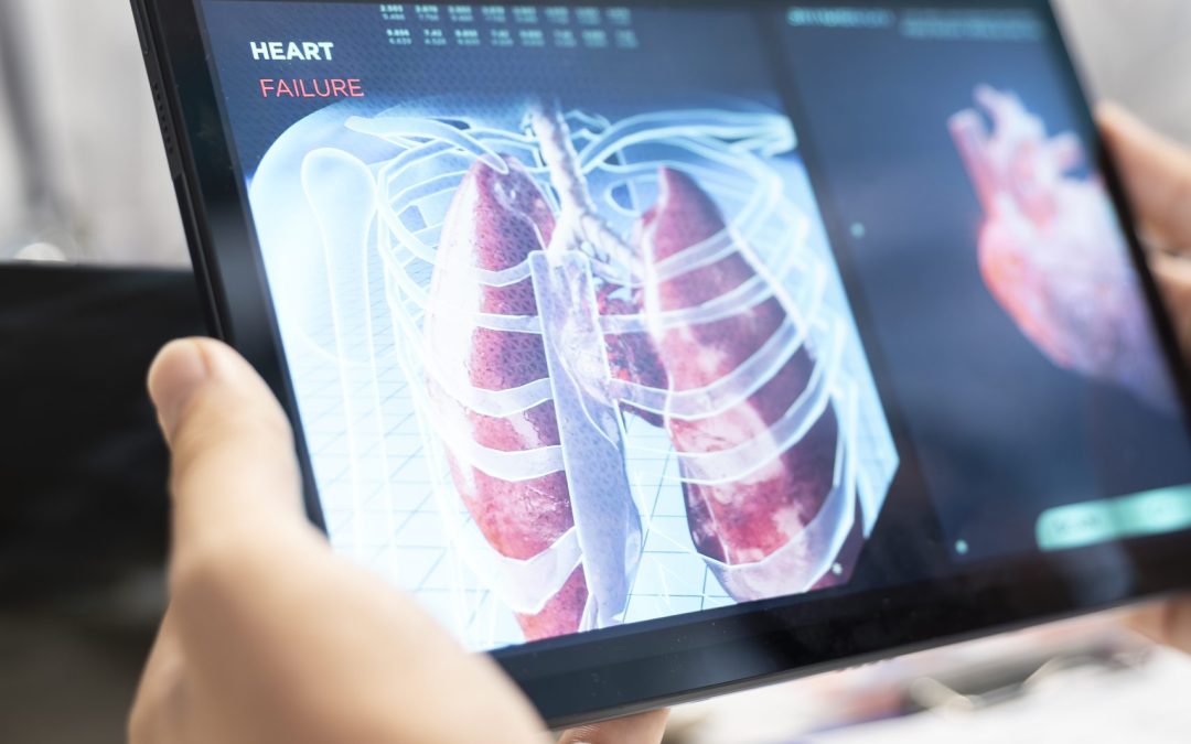 Obstrucción pulmonar y riesgo vascular: una señal temprana