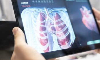 Obstrucción pulmonar y riesgo vascular: una señal temprana