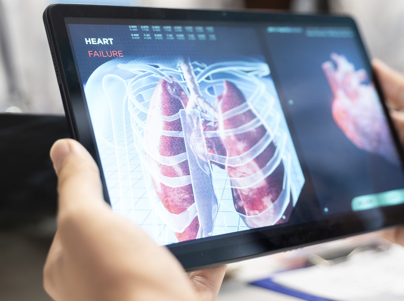 Medics and his staff meet to discuss lungs radiography for patient care strategy Tablet con imagen de pulmones